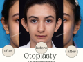 Beige Elegant Minimalist Beauty Skincare Before After Instagram Post - 23