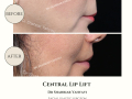 Beige Elegant Minimalist Beauty Skincare Before After Instagram Post - 30
