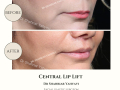 Beige Elegant Minimalist Beauty Skincare Before After Instagram Post - 31