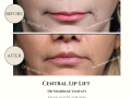 Beige Elegant Minimalist Beauty Skincare Before After Instagram Post - 32