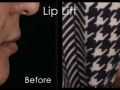 LL0017