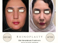 Beige Elegant Minimalist Beauty Skincare Before After Instagram Post - 11