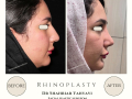 Beige Elegant Minimalist Beauty Skincare Before After Instagram Post - 12