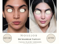 Beige Elegant Minimalist Beauty Skincare Before After Instagram Post - 13