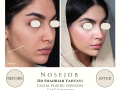 Beige Elegant Minimalist Beauty Skincare Before After Instagram Post - 14