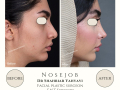 Beige Elegant Minimalist Beauty Skincare Before After Instagram Post - 15