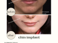 Beige Elegant Minimalist Beauty Skincare Before After Instagram Post - 29