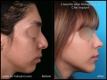 CI0026