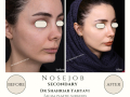 Beige Elegant Minimalist Beauty Skincare Before After Instagram Post - 11