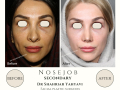 Beige Elegant Minimalist Beauty Skincare Before After Instagram Post - 16
