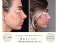 Beige Elegant Minimalist Beauty Skincare Before After Instagram Post - 23