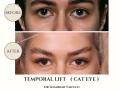 Beige Elegant Minimalist Beauty Skincare Before After Instagram Post - 22