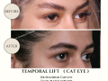 Beige Elegant Minimalist Beauty Skincare Before After Instagram Post - 23