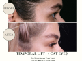 Beige Elegant Minimalist Beauty Skincare Before After Instagram Post - 24