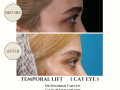 Beige Elegant Minimalist Beauty Skincare Before After Instagram Post - 25