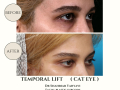 Beige Elegant Minimalist Beauty Skincare Before After Instagram Post - 26