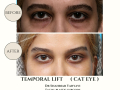 Beige Elegant Minimalist Beauty Skincare Before After Instagram Post - 27
