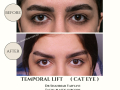 Beige Elegant Minimalist Beauty Skincare Before After Instagram Post - 28