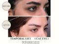 Beige Elegant Minimalist Beauty Skincare Before After Instagram Post - 29