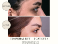 Beige Elegant Minimalist Beauty Skincare Before After Instagram Post - 30