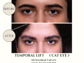 Beige Elegant Minimalist Beauty Skincare Before After Instagram Post - 31