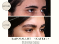 Beige Elegant Minimalist Beauty Skincare Before After Instagram Post - 33