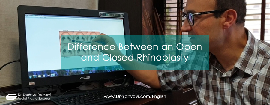 Difference Between an Open and Closed Rhinoplasty