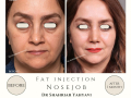 Beige Elegant Minimalist Beauty Skincare Before After Instagram Post - 16