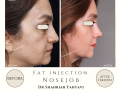 Beige Elegant Minimalist Beauty Skincare Before After Instagram Post - 18