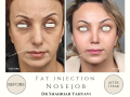Beige Elegant Minimalist Beauty Skincare Before After Instagram Post - 19