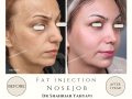 Beige Elegant Minimalist Beauty Skincare Before After Instagram Post - 20