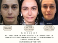 Beige Elegant Minimalist Beauty Skincare Before After Instagram Post - 25