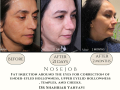Beige Elegant Minimalist Beauty Skincare Before After Instagram Post - 26