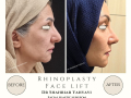 Beige Elegant Minimalist Beauty Skincare Before After Instagram Post - 10