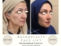 Beige Elegant Minimalist Beauty Skincare Before After Instagram Post - 9