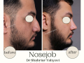 Beige Elegant Minimalist Beauty Skincare Before After Instagram Post - 10