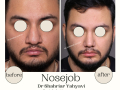 Beige Elegant Minimalist Beauty Skincare Before After Instagram Post - 8