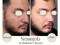 Beige Elegant Minimalist Beauty Skincare Before After Instagram Post - 9