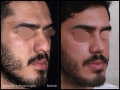 MI0006