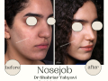 Beige Elegant Minimalist Beauty Skincare Before After Instagram Post - 7