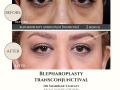 Beige Elegant Minimalist Beauty Skincare Before After Instagram Post - 27