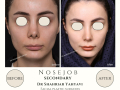 Beige Elegant Minimalist Beauty Skincare Before After Instagram Post - 10