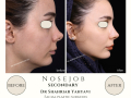 Beige Elegant Minimalist Beauty Skincare Before After Instagram Post - 12