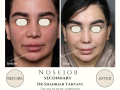 Beige Elegant Minimalist Beauty Skincare Before After Instagram Post - 13