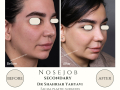 Beige Elegant Minimalist Beauty Skincare Before After Instagram Post - 14
