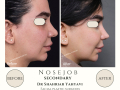 Beige Elegant Minimalist Beauty Skincare Before After Instagram Post - 15