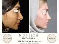 Beige Elegant Minimalist Beauty Skincare Before After Instagram Post - 17