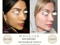 Beige Elegant Minimalist Beauty Skincare Before After Instagram Post - 18