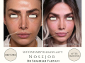 Beige Elegant Minimalist Beauty Skincare Before After Instagram Post - 22