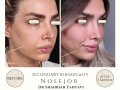 Beige Elegant Minimalist Beauty Skincare Before After Instagram Post - 24